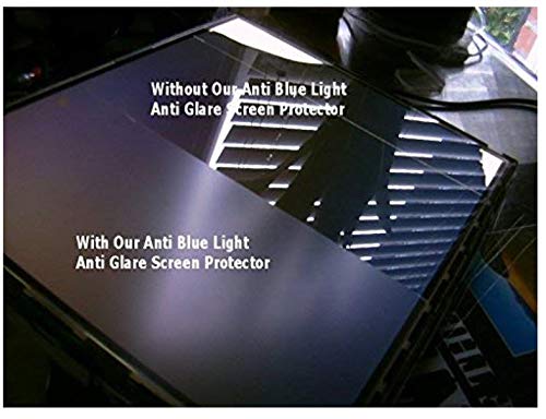 Starfilm Screen Protector For Lenovo Thinkpad X1 Carbon Gen8/Gen7/Gen6 14 Inch Anti Blue Light Anti Glare/Hd Screen Protector (1